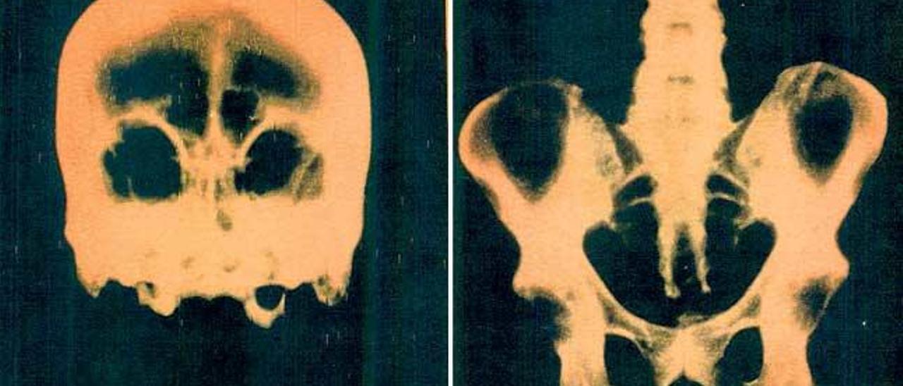 Cráneo y pelvis del beato Ramon Llull.