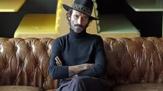 Leiva se abre en canal y cuenta cómo perdió su ojo izquierdo