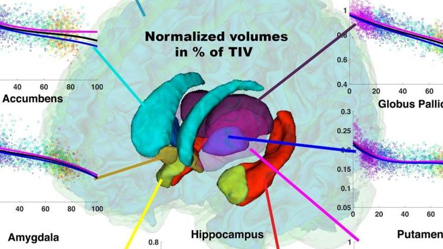 El cerebro de los hombres se atrofia a mayor velocidad que el de las mujeres