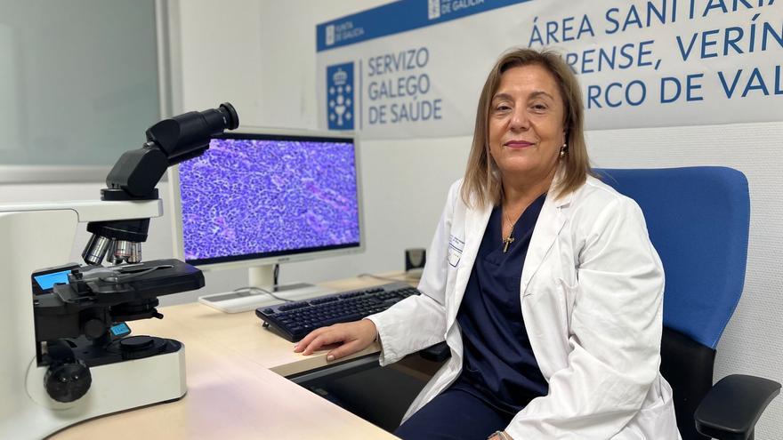 Los escáneres para Anatomía Patológica, dos para el hospital de Ourense, supondrán “una transformación digital”