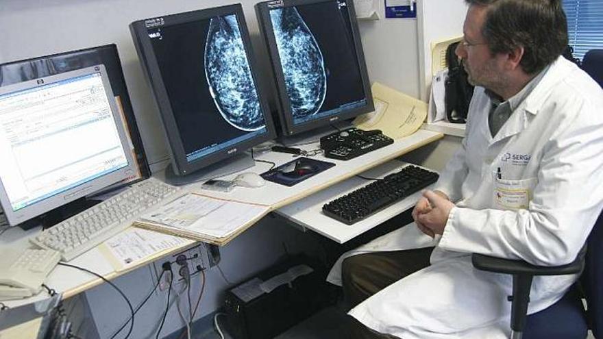 Un médico observa una mamografía digital. / casteleiro