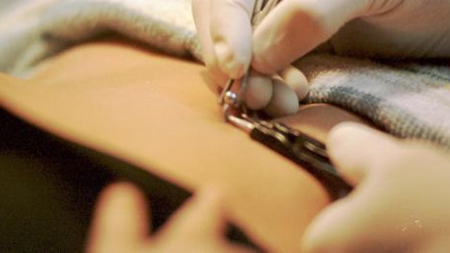 Un profesional se dispone a colocar un piercing.