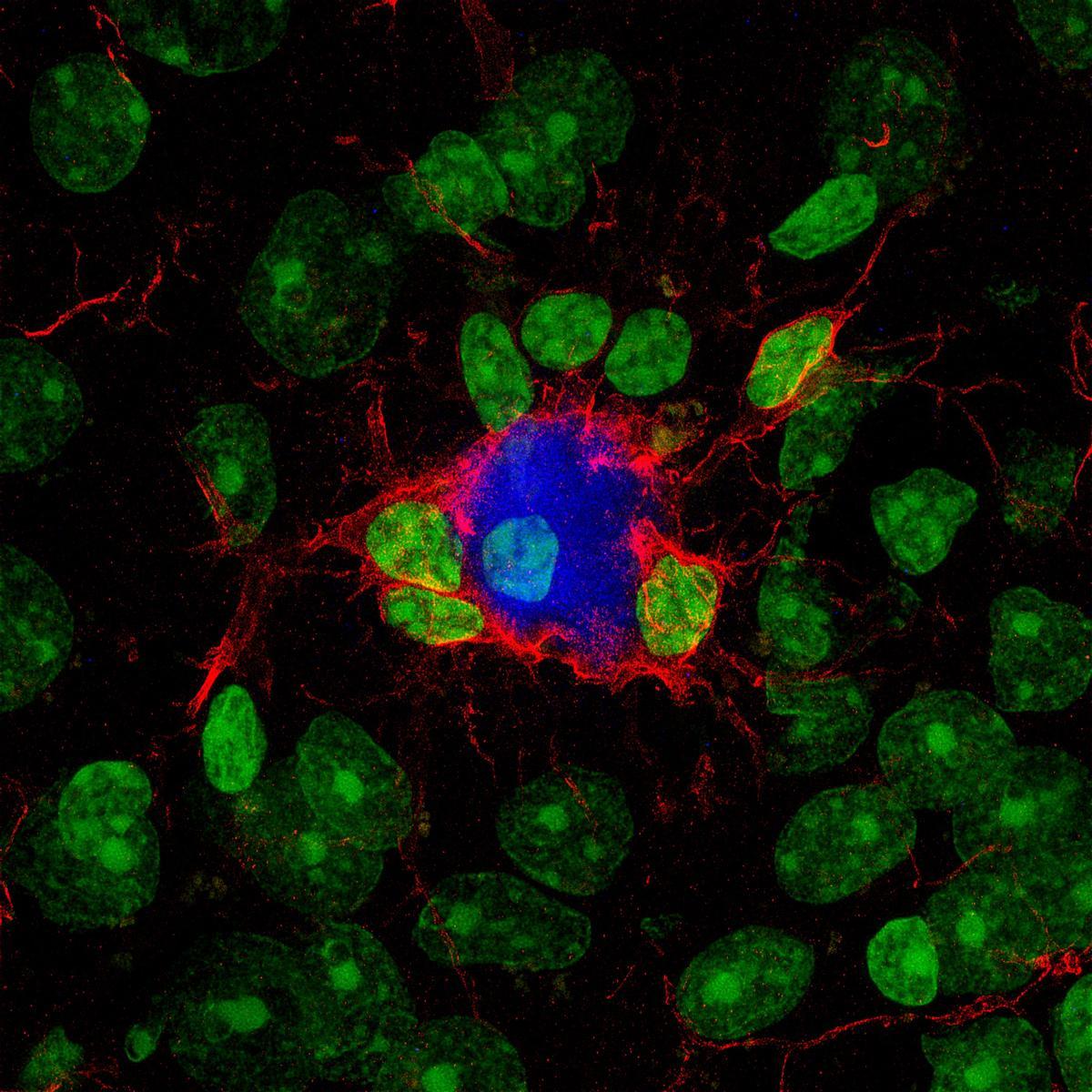 La microglía (en rojo) responde al tratamiento encapsulando y reduciendo el tamaño de las placas amiloideas (en azul) y protegiendo a las neuronas. Los núcleos celulares se muestran en verde.