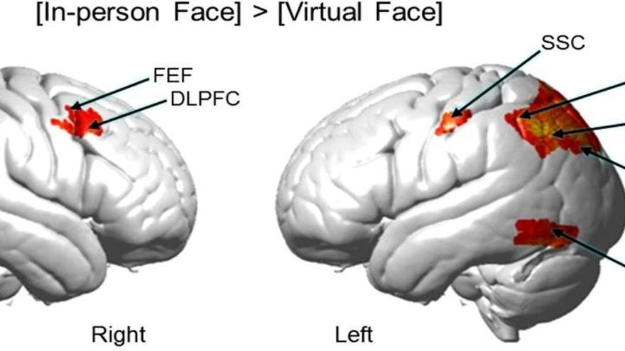 Comparación de las partes activadas del cerebro durante la conversación en persona y la videollamada.