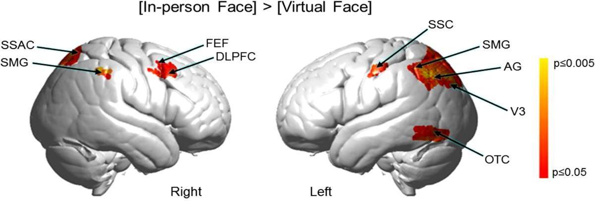 Comparación de las partes activadas del cerebro durante la conversación en persona y la videollamada.