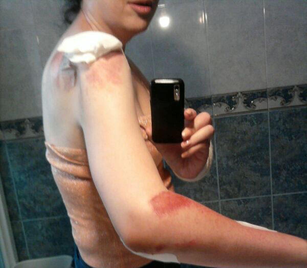 Una transexual denuncia haber sido agredida tras  el Orgullo Gay