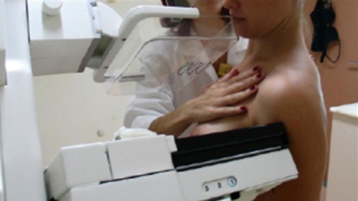 Prueba de mamografía