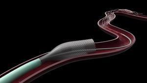 Una recreación digital del funcionamiento del sistema de Anaconda Biomed, llamado Funnel  Catheter