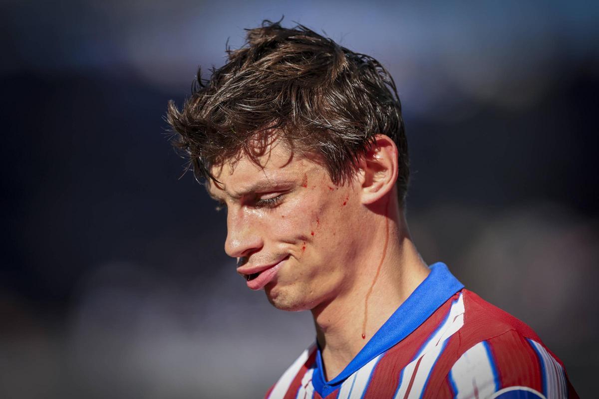 La herida en la cabeza de Le Normand