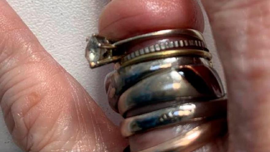 Vídeo: Bomberos retiran a una mujer seis anillos que aprisionaban su dedo anular