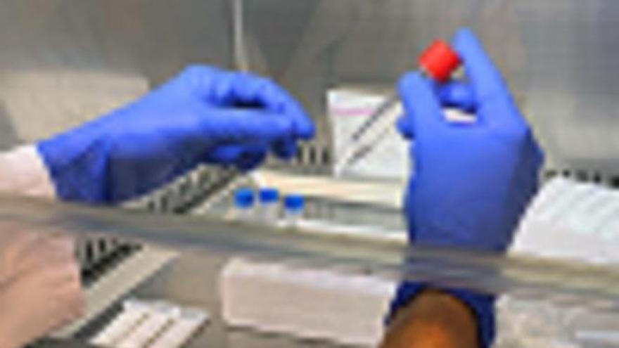 El hospital Quirónsalud Córdoba incorpora la PCR con muestra en saliva para detección de covid-19