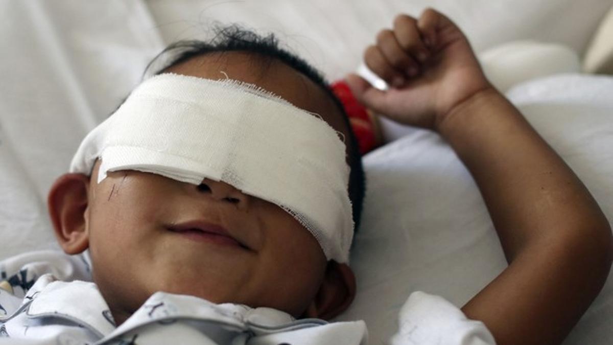 El pequeño Binbin, de seis años, en el hospital en el que lo atendieron tras perder los ojos, el pasado 29 de agosto.