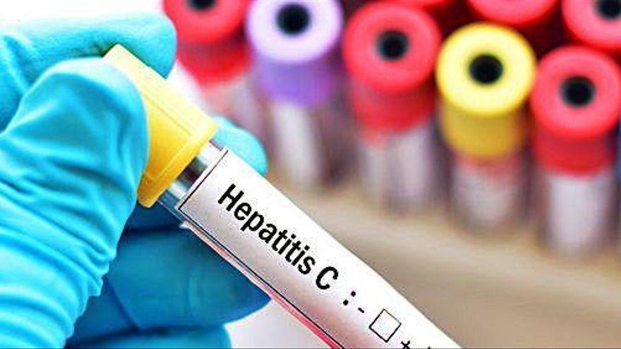 Hepatitis C: Una de cada cinc persones a Catalunya desconeix que està infectada