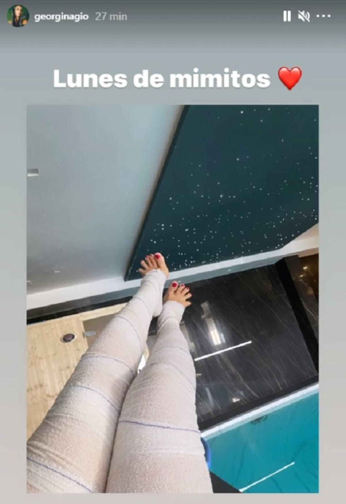Georgina Rodríguez con las piernas vendadas