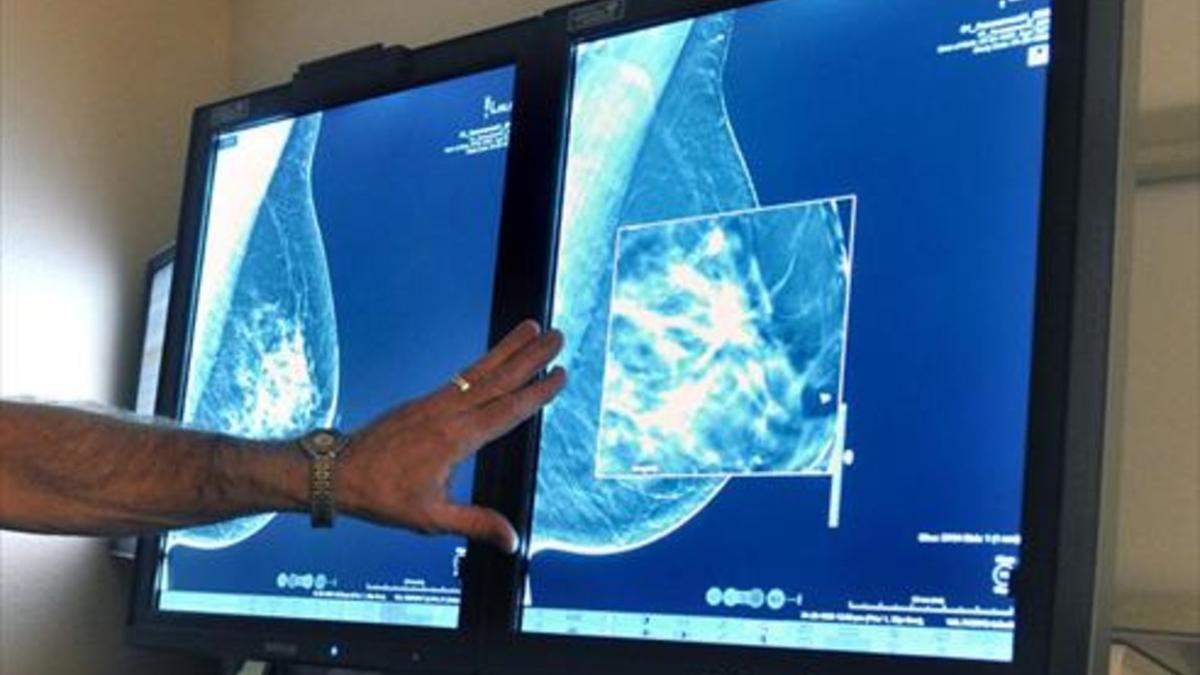 Un radiólogo compara dos mamografías para detectar tumores en un hospital de Wichita Falls (Tejas, EEUU).
