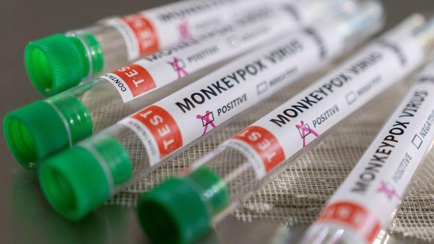 Canarias registra cuatro nuevos casos de viruela del mono