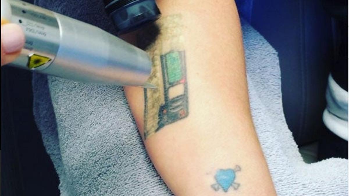 Kelly Osbourne comienza a eliminar sus tatuajes con láser