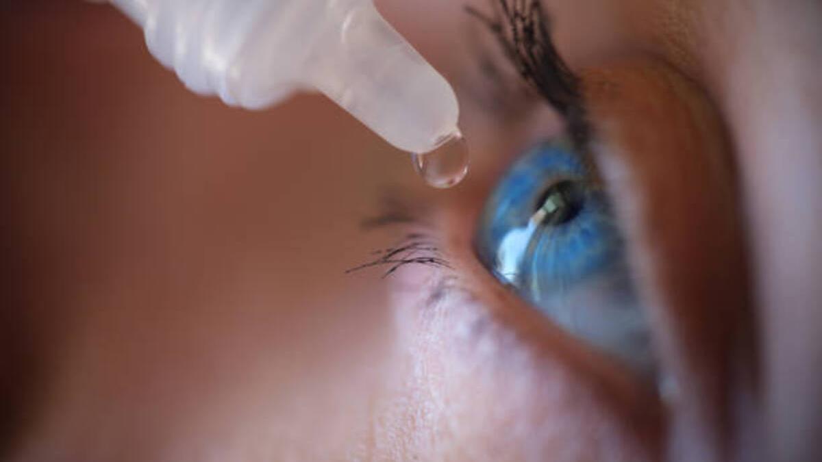 Una mujer aplicándose gotas de colirio en los ojos.