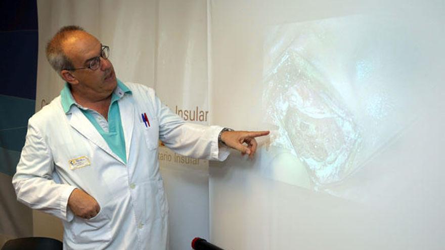 Ángel Ramos explica los detalles de la operación ante una pantalla