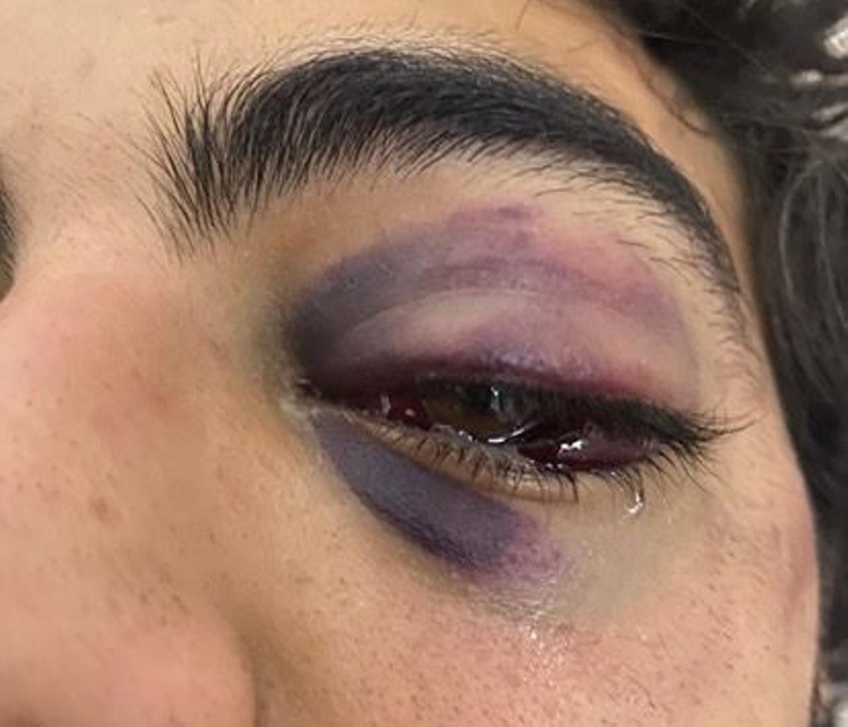 Imagen de la víctima de la agresión (cedida)