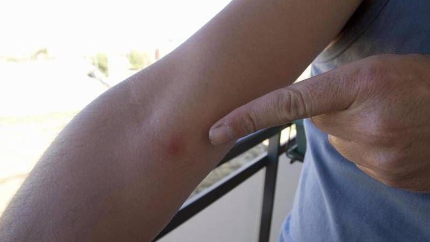 Más de 28.000 aragoneses fueron tratados de picaduras de mosca negra en junio de 2017