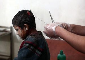 Un infermer cus la ferida al cap a un noi sirià ferit durant un bombardeig del règim sirià contra els civils a Duma, una localitat a 13 quilòmetres al nord-est de Damasc, l’11 de novembre passat.
