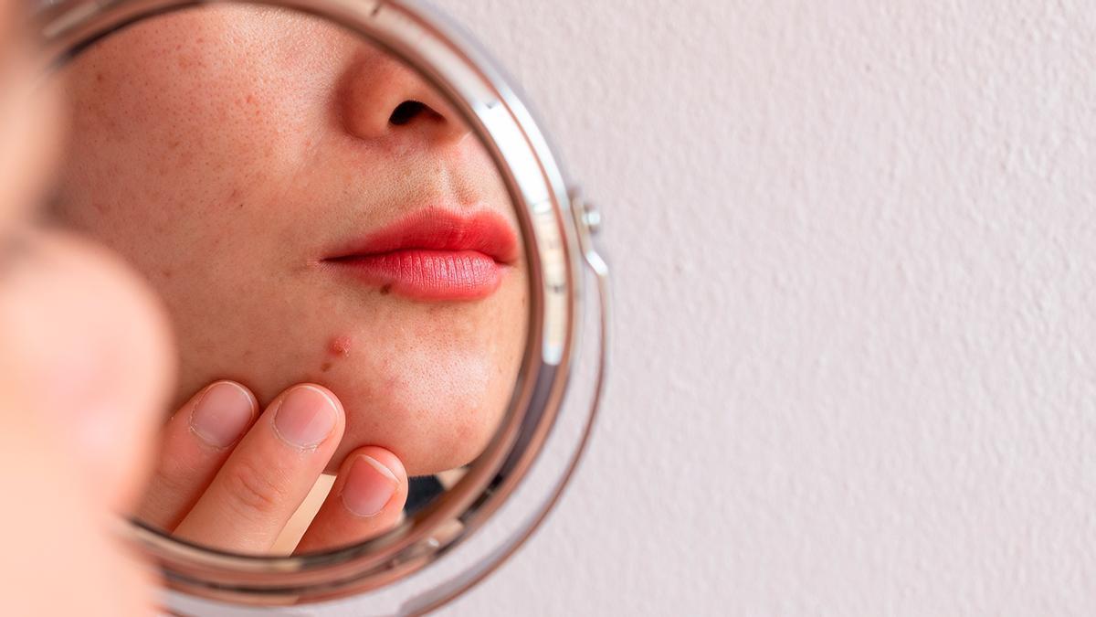 La vitamina exfoliante de Lidl que elimina las espinillas y los poros obstruidos del rostro
