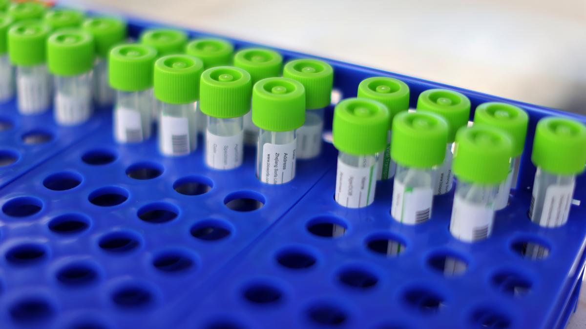 FILE PHOTO: PCR coronavirus tests are seen at a testing site, as the global outbreak of the coronavirus disease (COVID-19) continues, in Malibu