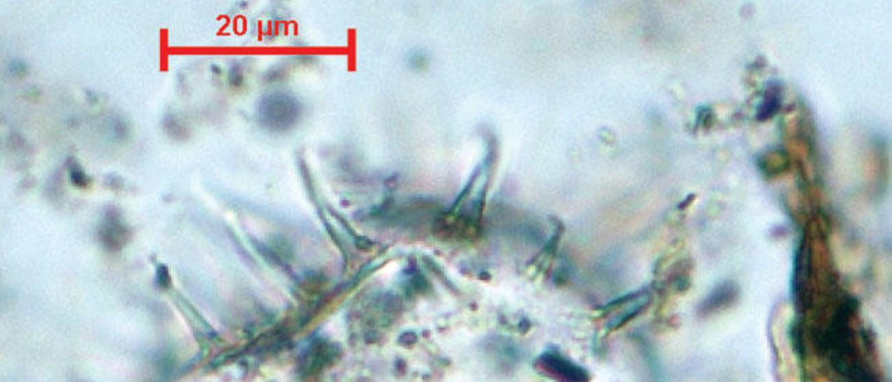 Muestra microscópica de un dinoflagelado (alga unicelular).