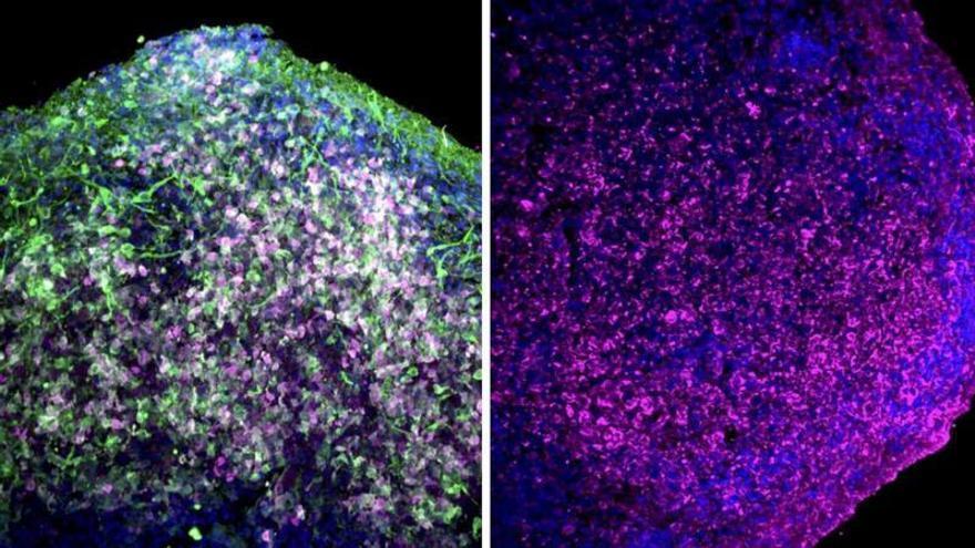 Crean organoides de la glándula pineal capaces de producir melatonina y revelar los secretos del sueño