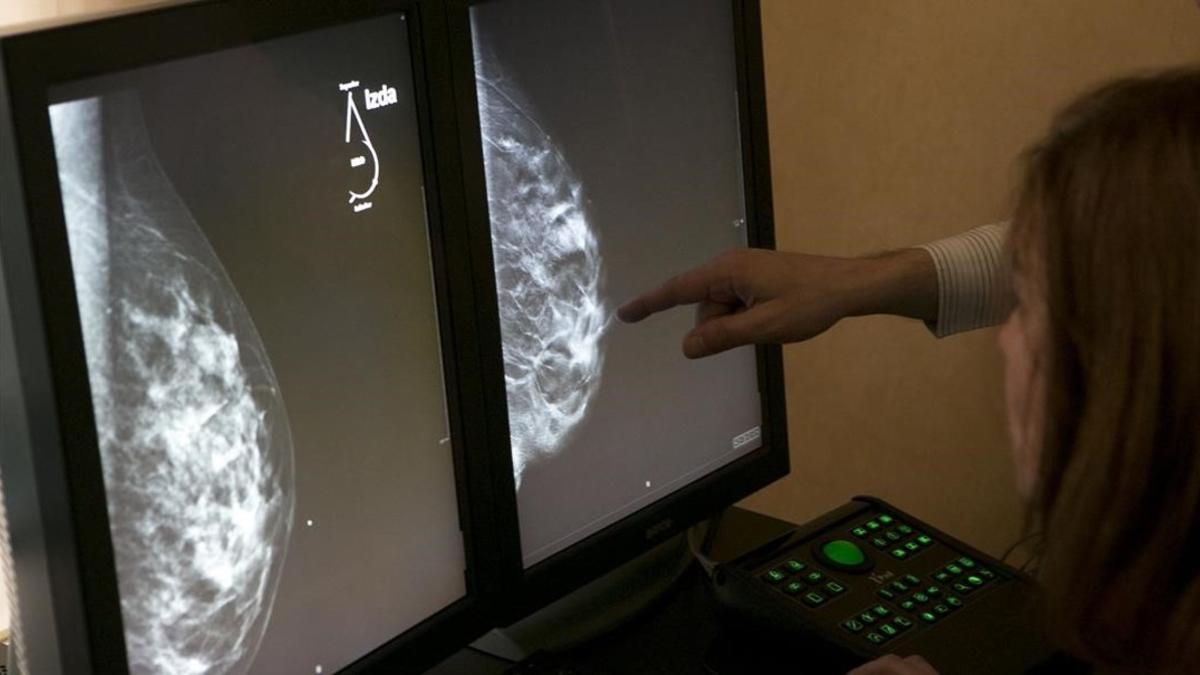 Una mamografía digital en 3D.