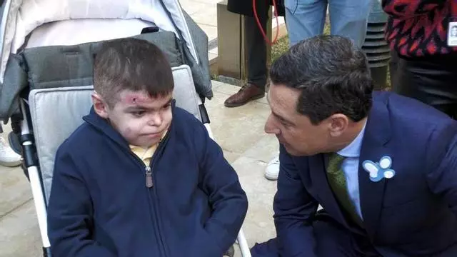 Andalucía asumirá el coste del tratamiento de Leo, el niño con piel de mariposa