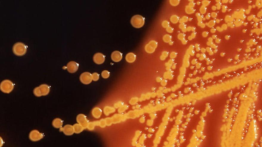 Colonias de la bacteria E. Coli vistas desde el microscopio