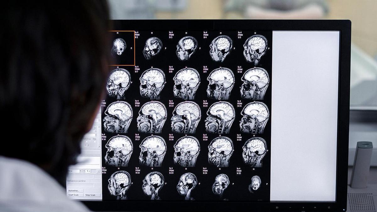 Resonancia magnética de un cerebro.