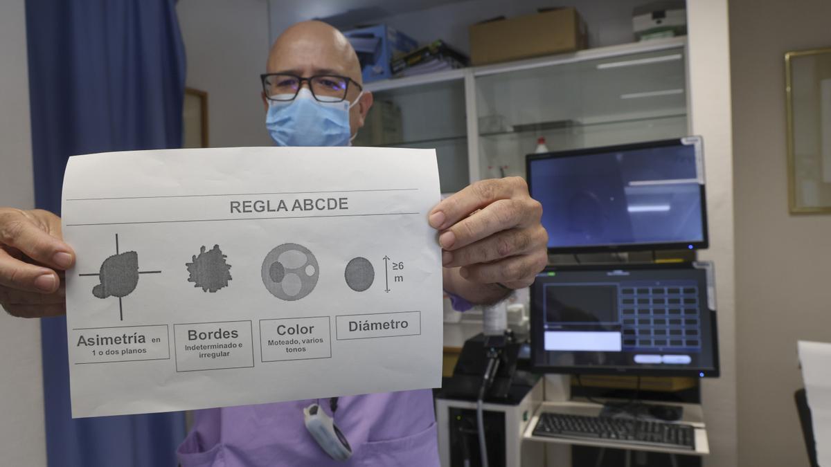 El doctor José Bañuls sosteniendo la regla del 'A, B, C, D, E' para el cáncer de piel.