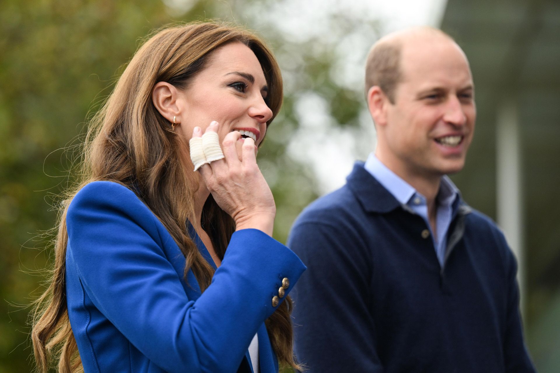 Kate Middleton reaparece con los dedos vendados