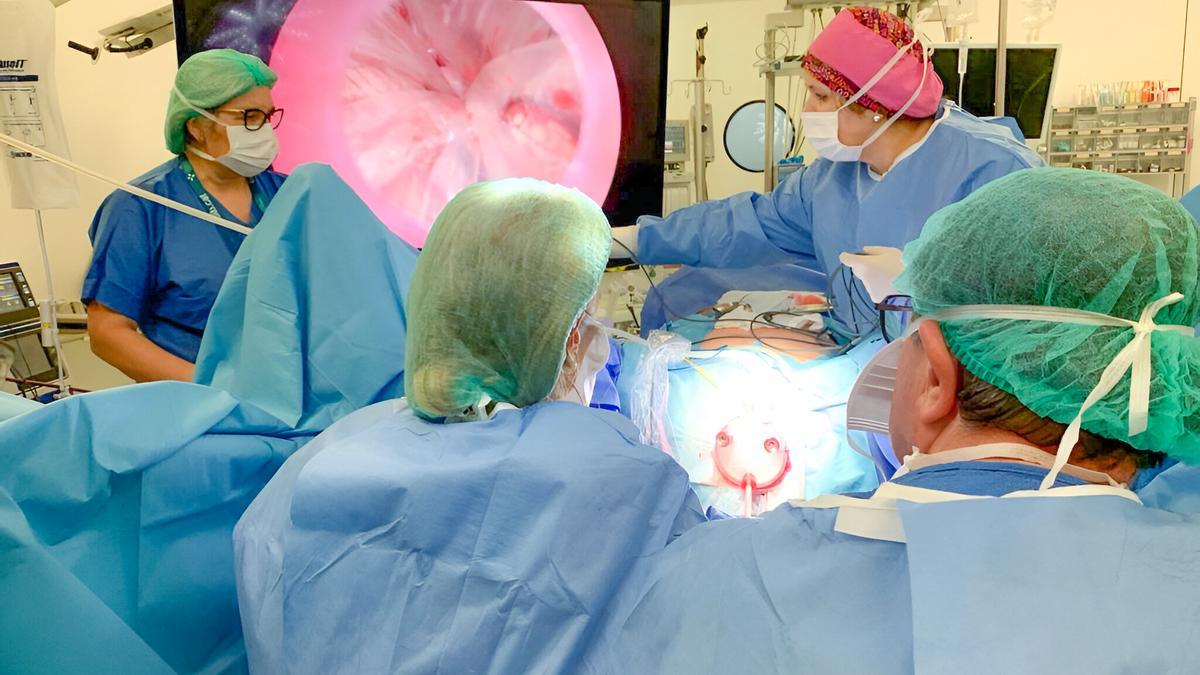 Intervenció per laparoscòpia a l&#039;Hospital Universitari d&#039;Igualada