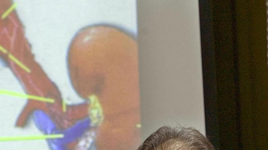 Málaga. José Ramos, cirujano de trasplante renal del Carlos Haya.