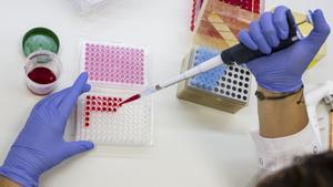 La Vall d’Hebron prossegueix l’assaig d’un fàrmac contra el càncer de pàncrees després dels bons resultats