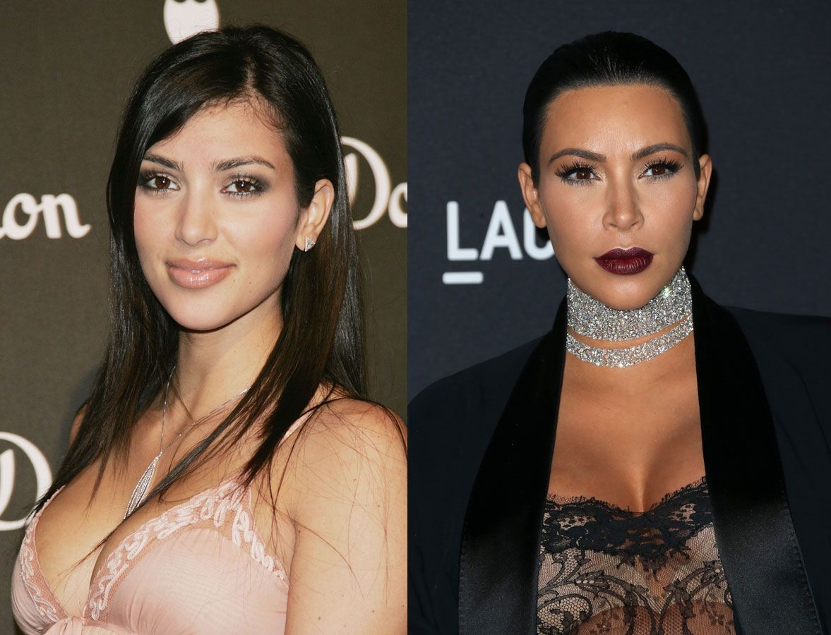 El antes y el después: Kim Kardashian