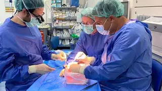 Investigadores de Murcia usan la IA para predecir si un trasplante de hígado llegará a buen puerto