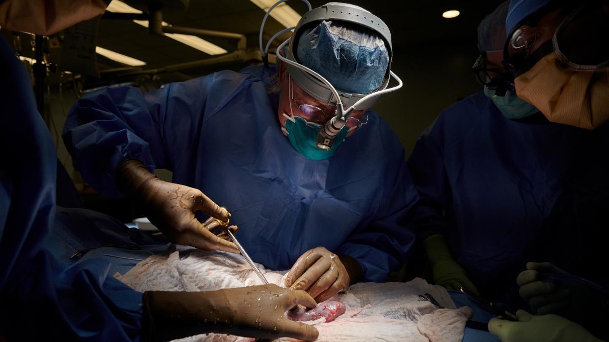 Trasplante de riñón en el NYU Langone