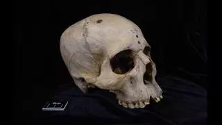 Un cráneo egipcio de 4.000 años muestra signos de un posible tratamiento contra el cáncer