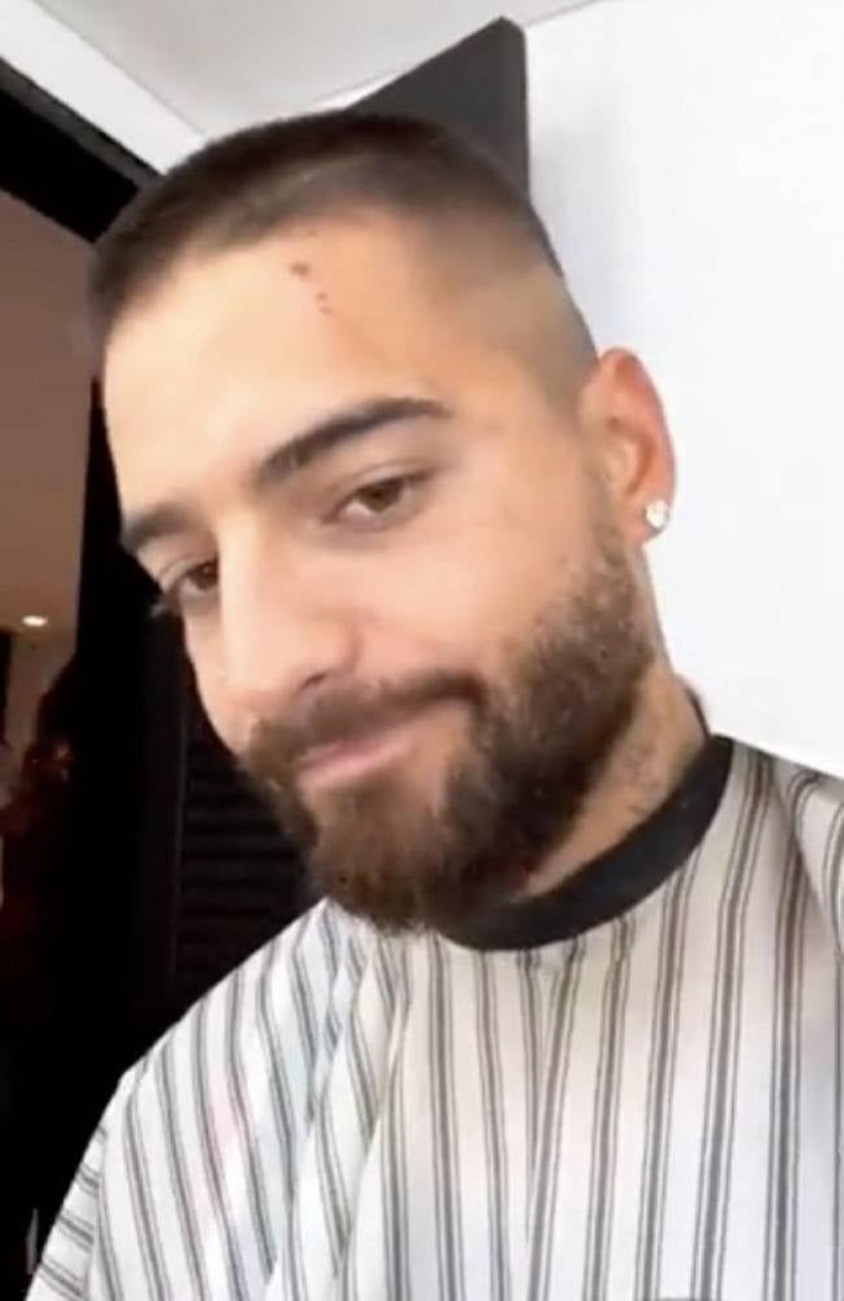 Maluma enseña las heridas provocadas por el ataque de uno de sus perros