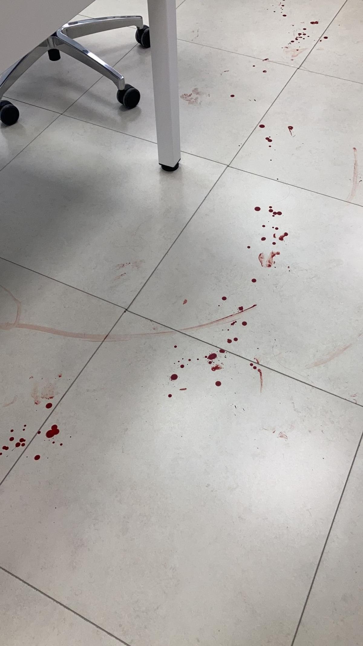 Restos de sangre de una de las heridas en el tiroteo de este viernes en el PTA.