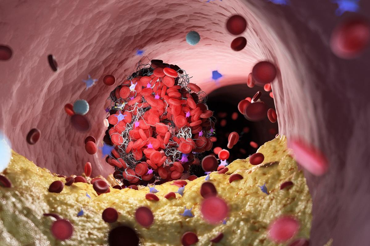 Los cardiólogos advierten del peligro de los excesos navideños