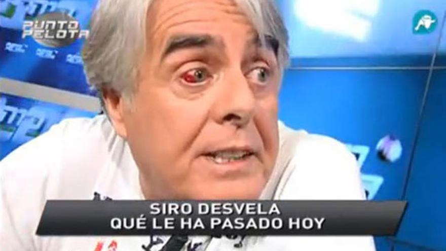 Siro López con un derrame en el ojo.