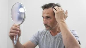 Caída de pelo en hombres: seis productos que ayudan a combatir la alopecia