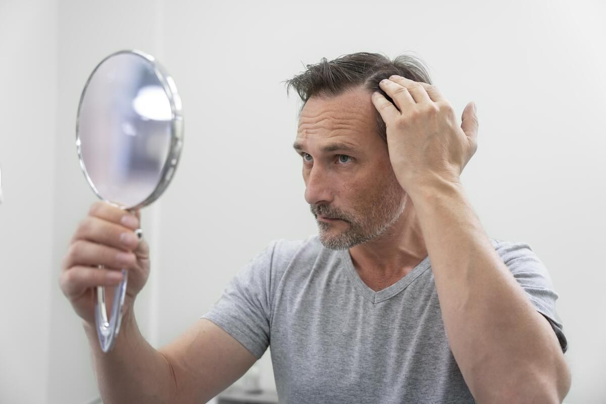 Caída de pelo en hombres: seis productos que ayudan a combatir la alopecia