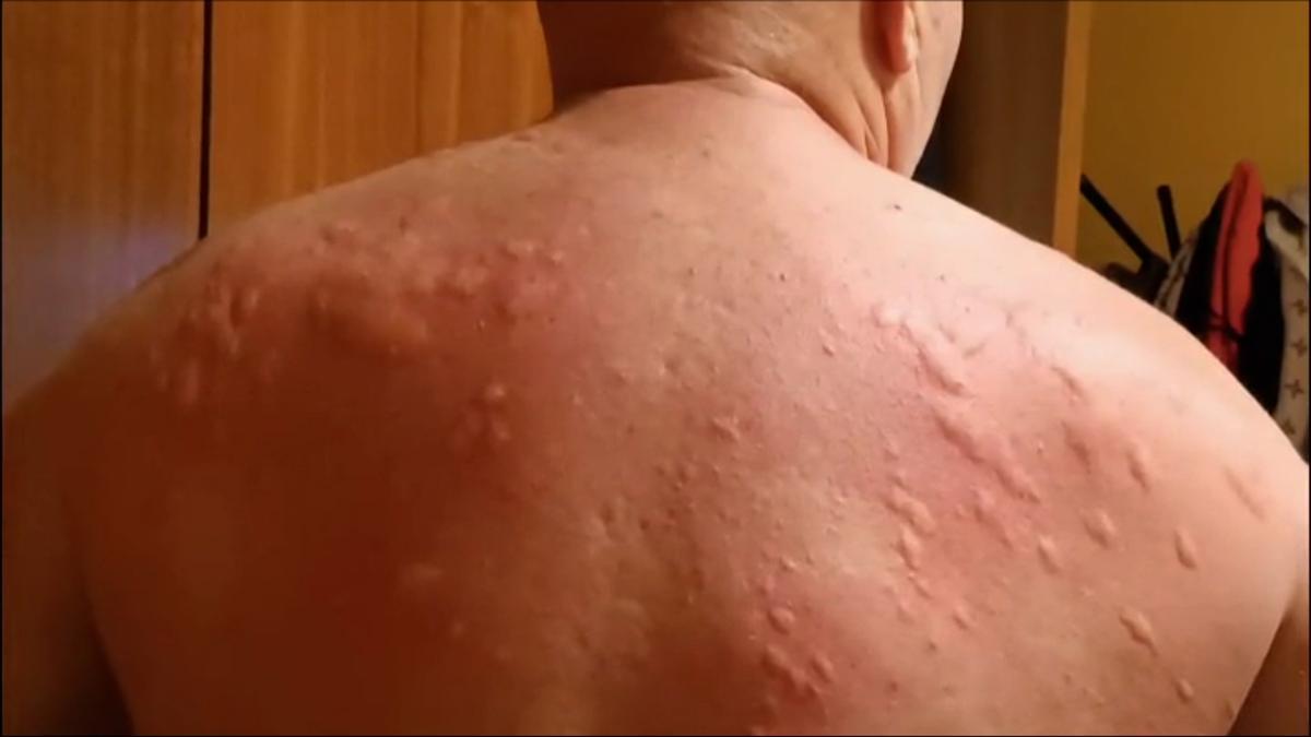 Plaga de mosquitos en Castellón